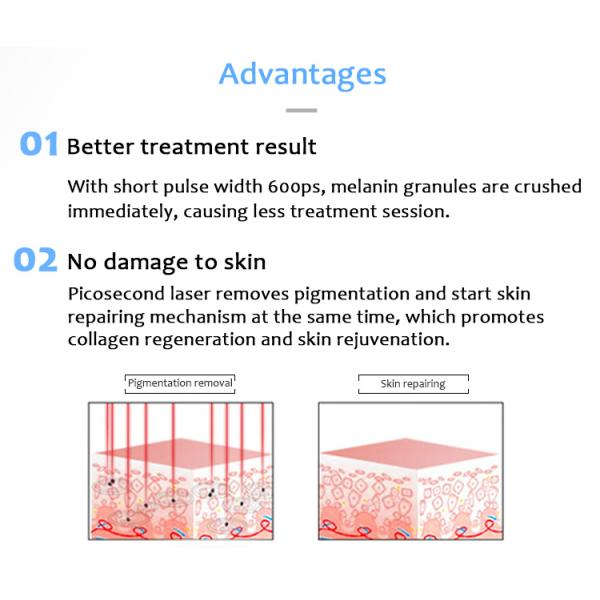 Nd Yag Laser Tattoo Removal Machine