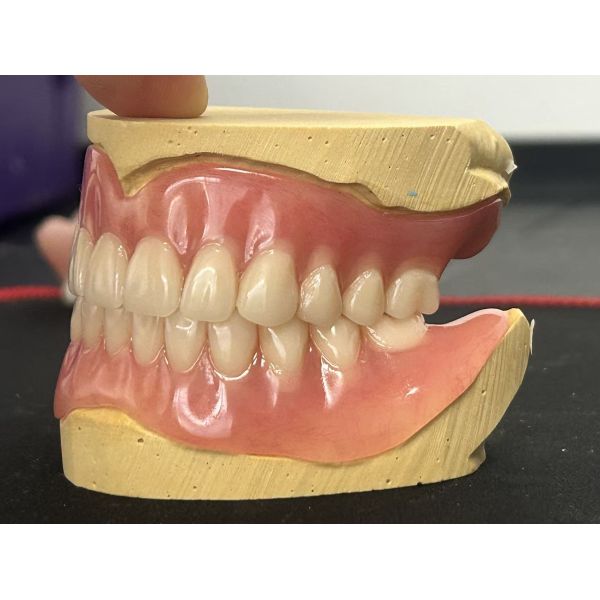 Custom Full Denture with Natural Appearance and Comfortable Fit for Complete Arch Restoration