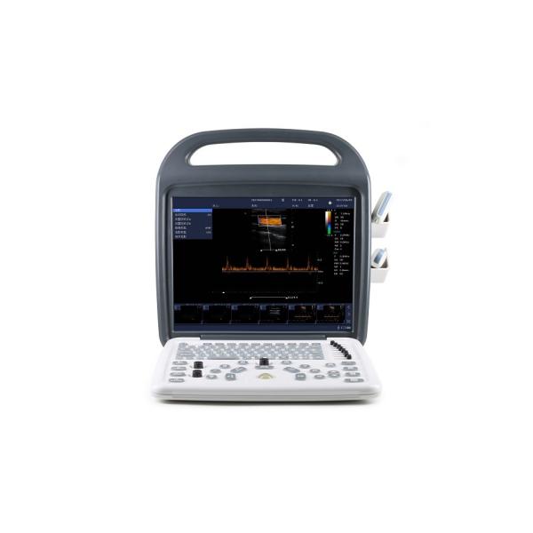 DCU10 Portable Color Doppler Ultrasound System with 15-inch HD Display for OB/GYN, Abdomen and Cardiac Imaging
