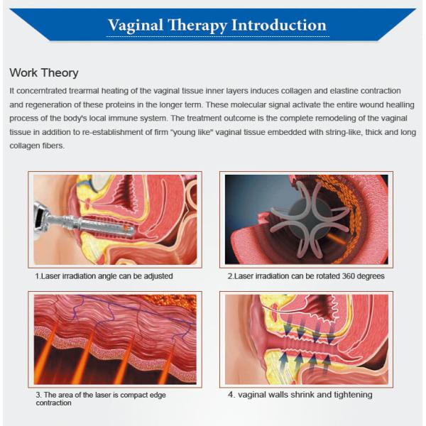 машина подмолаживания машины 60W лазера СО2 400mj частичная влагалищная