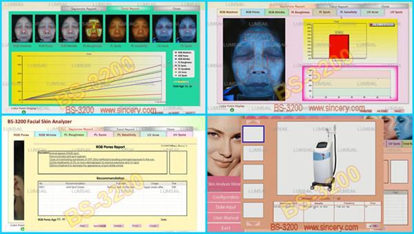 canon scanner ptz wired cameras dermatology skin moisture analyzer salon processor
