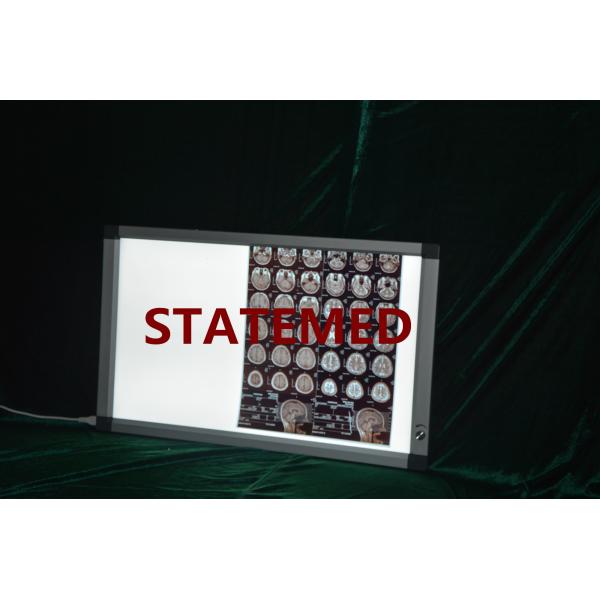 Customized Double Panel LED X Ray Film Viewer Negatoscope Digital Control Brightness