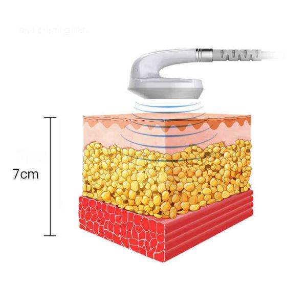 OEM 7 Tesla Pelvic Floor Muscle Strengthening Machine 2 Working Handles