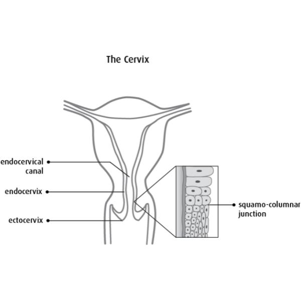 Umbrella Head Cervical Cytology Brush