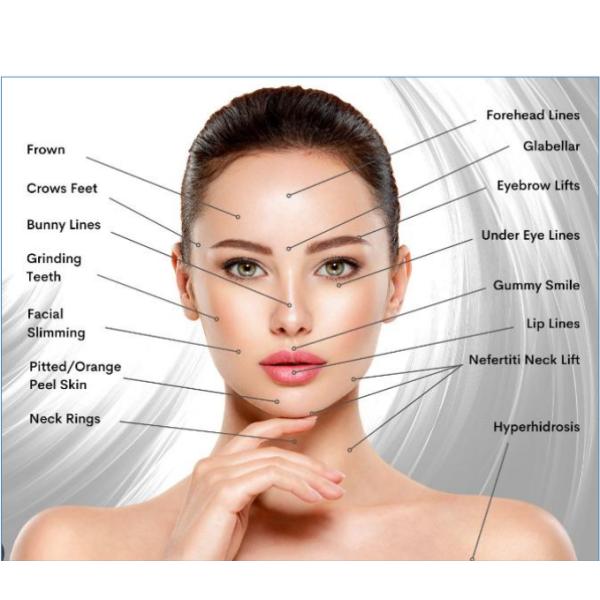 Clínica de belleza HIFU máquina de levantamiento facial antiedad RF máquina de levantamiento facial