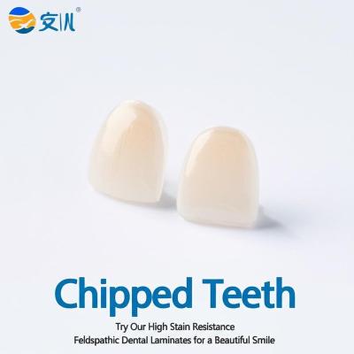 Affordable 0.3-0.5mm Thickness Feldspathic Dental Veneers with 16 Shades Color Options