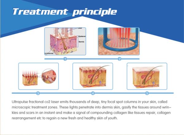 Bottom factory price!!! High quality rf skin rejuvenation vaginal tightening medical fractional co2 laser equipment