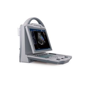 Color Doppler Ultrasound