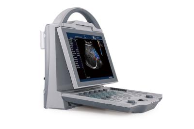 16GB Entry Level 2D Laptop Color Doppler Ultrasound System For Pregnancy
