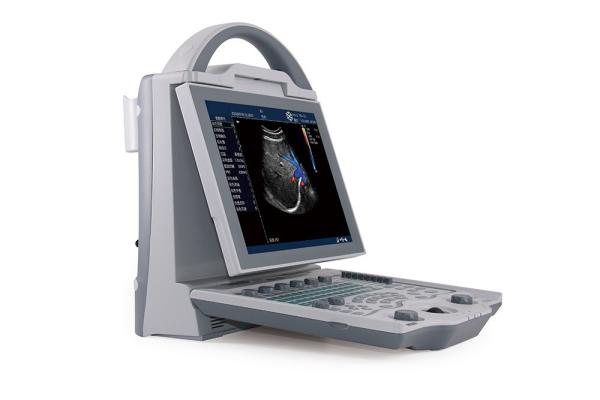 16GB Entry Level 2D Laptop Color Doppler Ultrasound System For Pregnancy