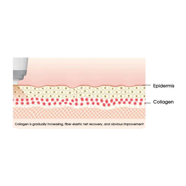 Home Ultrasound Beauty Machine , Rf Skin Tightening Machine Shrink Enlarged Pores