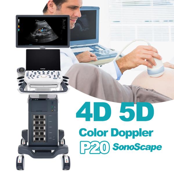 Sonoscape Portable Color Doppler Ultrasound Sonoscape S22 Ultrasound Machine Sonoscape P20 Doppler Ultrasound