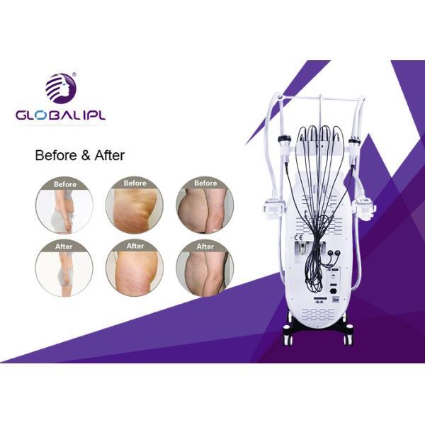 Máquina de dissolução gorda do RF Cryolipolysis CE da visualização ótica de tela táctil de 8,4 polegadas assegurado