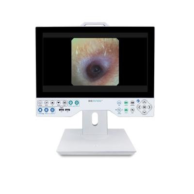 All in One Rigid and Flexible Endoscopy Camera TU-15LSD1E HDMI/SDI/CVBS/VGA/DVI Output Interface and Built-in Light Source
