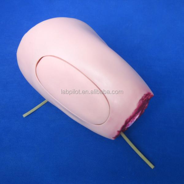 Advanced PVC Model The Ideal Solution for Lower Limb Trauma Thigh Amputation Nursing