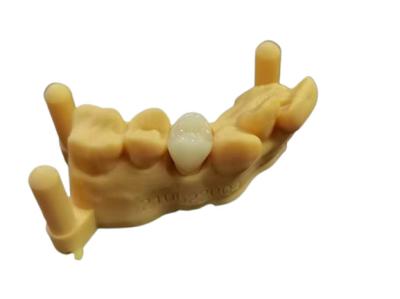 OEM 3D Printing Flexible Acrylic Denture Dental lab Digital Design