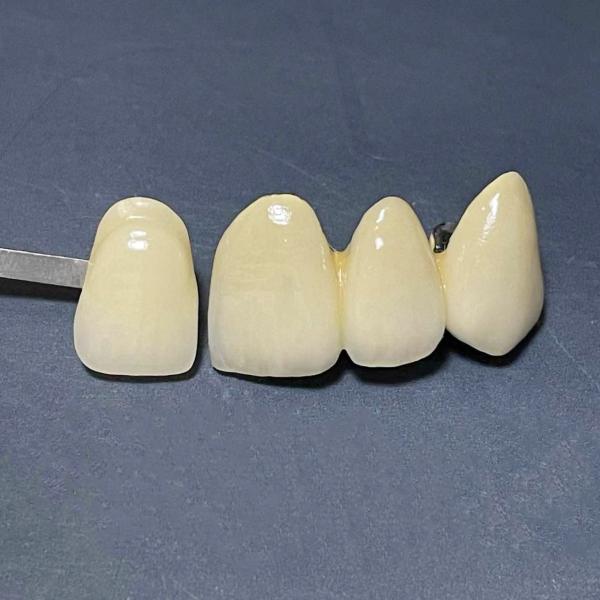CE 1.5KW Dental Porcelain Furnace 120V Dental Lab Porcelain Oven
