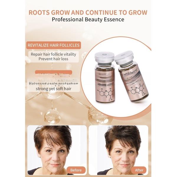Private Label Stalidearm Hair Growth Product Scalp Essential Serum Regrowth Hair Loss Treatment