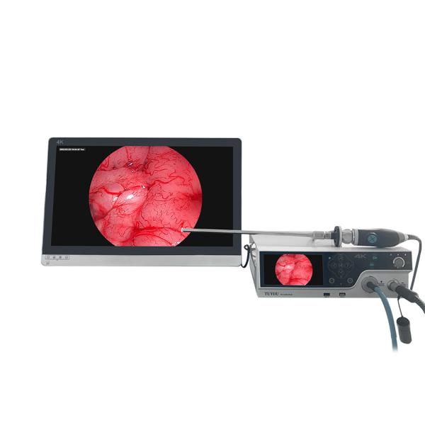 TUYOU 4K Medical Endoscope Camera System With Cold Light Source For ENT, Urology, And Laparoscopy