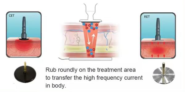 3 em 1 Tecar Diatermia Dores nas costas 448k Indiba Radiofrequência Ret Cet RF Bracelet Vaginal Tightening Machine