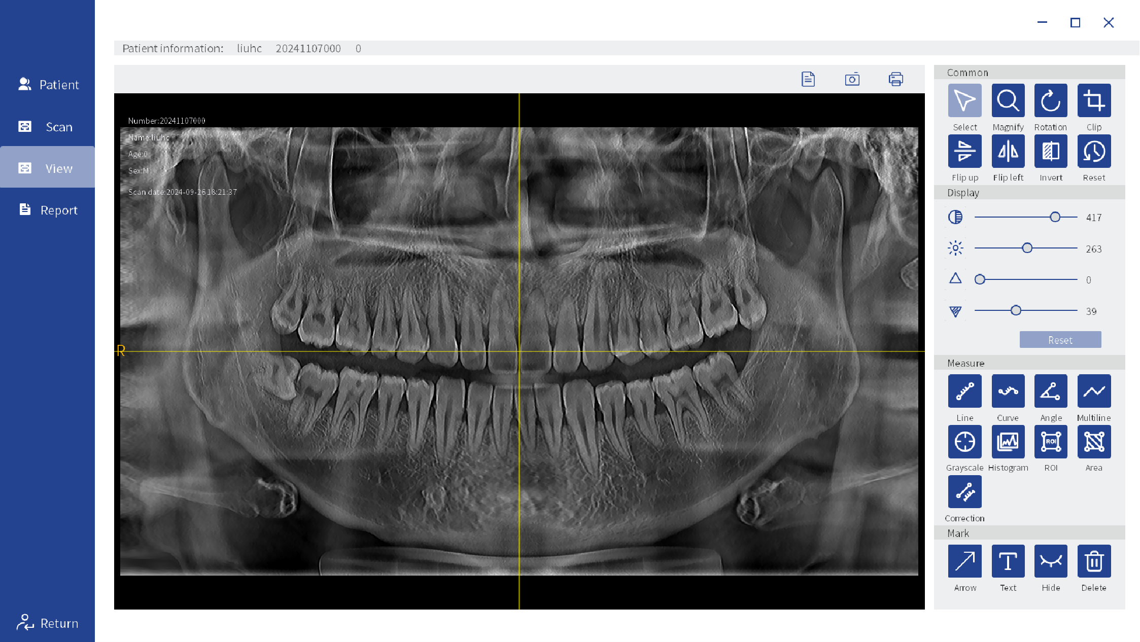 Dental Implant Orthodontic CBCT System High-Resolution 3D Imaging for Precise Diagnosis