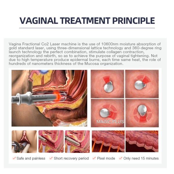 Коммерческая лазерная машина для восстановления кожи с углекислым газом 10600 нм