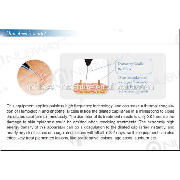 Best price 30MHz professional high frequesncy spider vein removal machine/ soften blood vessels for facial care