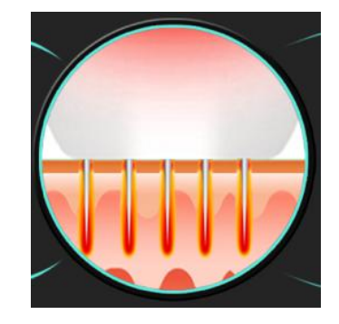 Gold Radio Frequency Body Skin Tightening Machine Facial Radio Frequency Machine