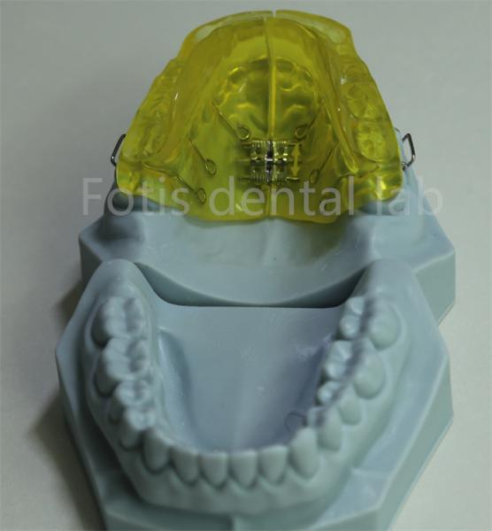 Customizable Orthodontic Retainer for China Dental Lab