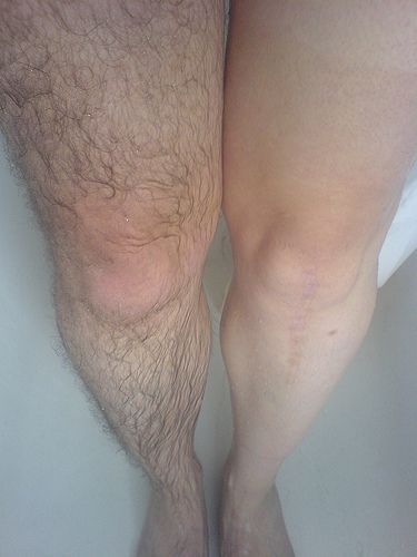 Cuatro longitudes de onda Máquina de belleza multifuncional 2400W Máquina de depilación láser