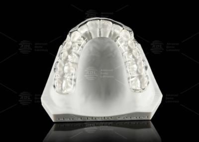 Hard Occlusal Splint Dental For Jaw Pain Relief Protection Oral Splint