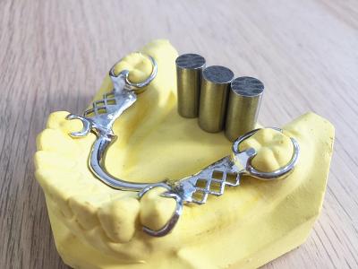 High Intensity Cobalt Iron Alloy , Metal Alloy Used For Dental Fillings 45% Cobalt
