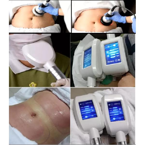 Rf Cavitation sous vide Body Slimming Machine de beauté Utilisation dans les salons