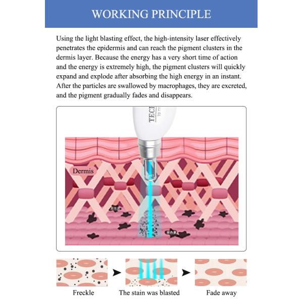 Picosecond Laser Machine Q Switch Nd Yag Laser Tattoo Removal Equipment