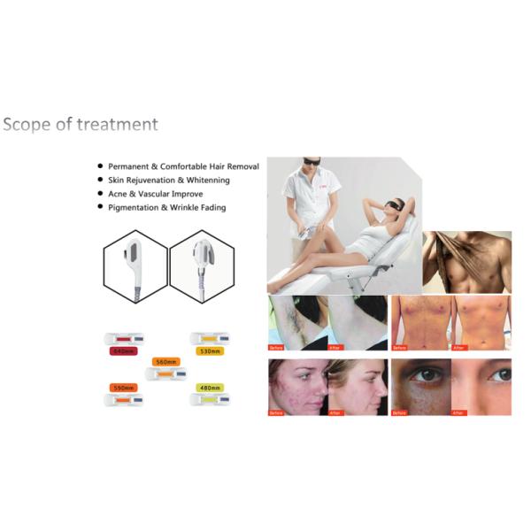 1.2 Million IPL Skin Rejuvenation Machine For Vascular Wrinkly Acne Therapy