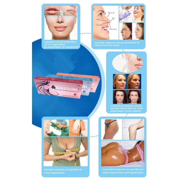 Перекрестный соединенный Filer губы 24mg 1ml Hyaluronic кисловочный дермальный с Lidocaine