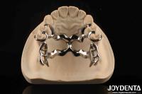 Alloying Metal Materials Dental Framework Suppleness for Oral Health Practitioners
