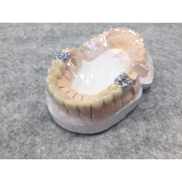 270HV10 Hardness Nickel Chrome Alloy Highly Reliable Metal To Ceramic Bond