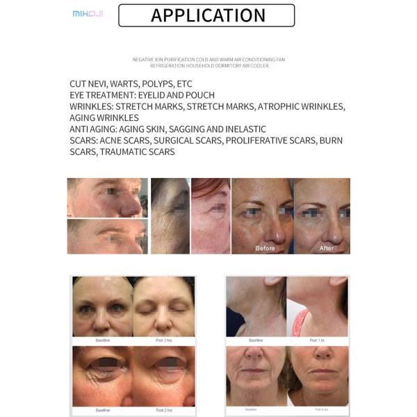 Плазма Горячая и холодная косметическая машина Напряжение 110V/220V 50Hz/60Hz Операционная система Плазма