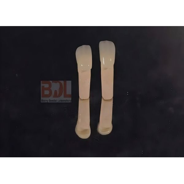 High Fracture Toughness Ceramic Dentures with High Translucency and Low Thermal Conductivity for Dental Restorations