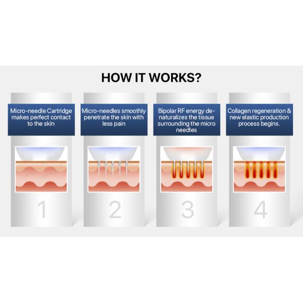 Vaccum Micro Needle RF Machine Vertical 2 In 1 Standing For Skin Care