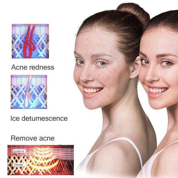 4 In1 Home Beauty Machine 500000 Pulsed IPL Laser Hair Removal Permanent Epilator Armpit