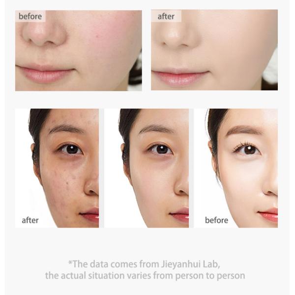 Косметики ODM Bodycare забеливая глубокую Moisturizing ровную сливк Arbutin лицевую