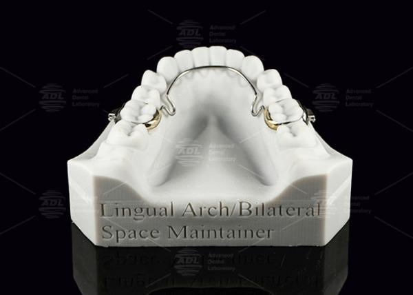 Lingual Arch Biliteral Space Maintainer Stainless Steel Teeth Space Maintainers