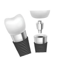 O implante dental barra a inovação material para o desempenho superior