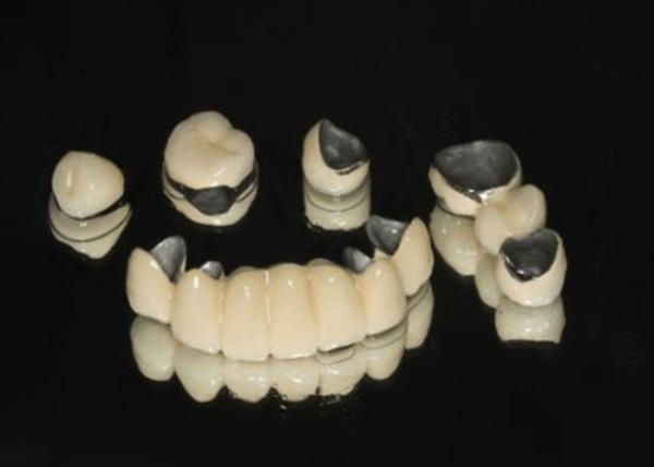 Porcelana fundida a metal PFM resistência ao desgaste dental da coroa para odontologia restaurativa