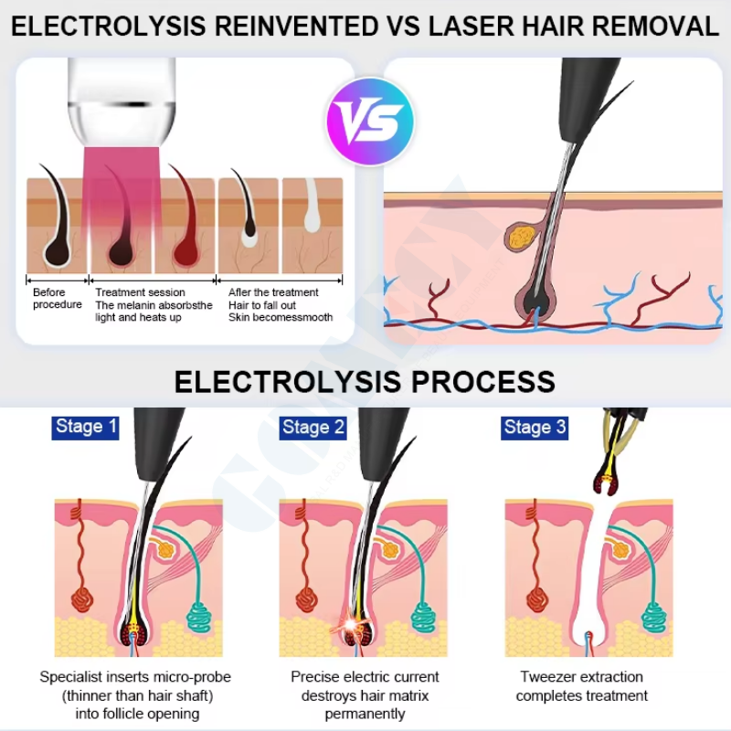 RF High Frequency Vascular Removal And Electrolysis Hair Removal Machine For Beauty Clinic And Aesthetic Salon