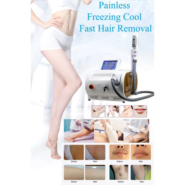 Multifunction IPL Laser Beauty Machine 480nm 530nm 640nm E-Light IPL Machine