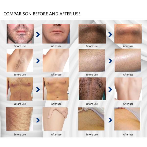 Multifunctional IPL Laser Beauty Machine For Tattoo Removal Maximum Energy 2000M