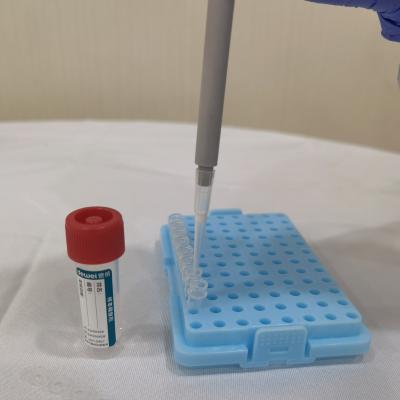 Nasal Flocked Swab Viral Preservation Reagent Sample Release in 5 Seconds without Extraction Direct PCR